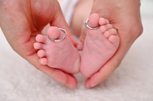 哈尔滨孕妇怎样预防妊娠纹